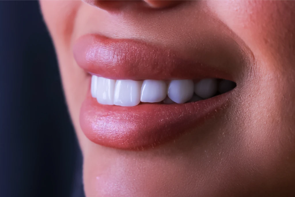 Zygomatic Implants Zygomatic Implants